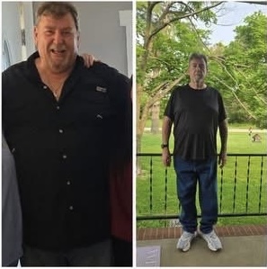 Patient down 62 lbs — Program complete